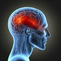 smärta medicinsk huvud anatomi blå röd röntgen hjärna medicin huvudvärk. generativ ai. foto