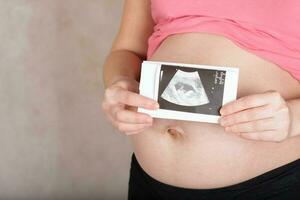 ung gravid kvinna håller usg bild av henne bebis. foto