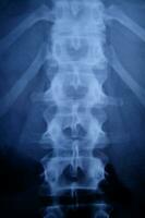 en x - stråle bild av en personens tillbaka foto