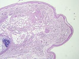 histologi mänsklig vävnad med mikroskop från laboratorium foto