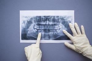 kvinnlig tandläkare som håller en tandröntgen foto