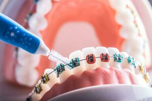 tand modell från dental tandställning med inter dental tänder rengöring borsta foto