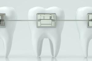 dental tandställning och de tänder, 3d tolkning. foto