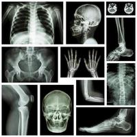 uppsättning röntgen flera delar av människan foto