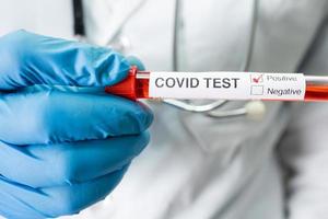 positivt blodinfektionsprov i provrör för covid-19 coronavirus i lab. forskare som håller för att kontrollera och analysera för patient på sjukhus. foto