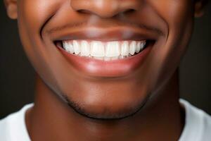 strålnings leende - närbild av man med skön tänder. generativ förbi ai foto