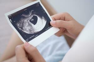 gravid kvinna är ser på ett ultraljud Foto av foster. mor försiktigt finputsning de bebis på mage. Lycklig, familj, tillväxt, graviditet, njutning , förbereda nyfödd, ta vård, sjukvård, mage.