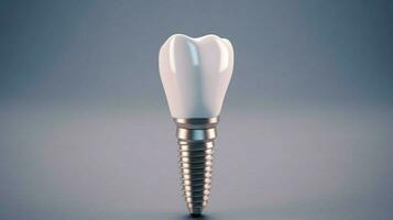 dental vård implantera foto