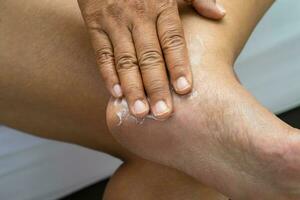 kvinna vård fötter med sprucken och torr häl hudkräm hemma. foto