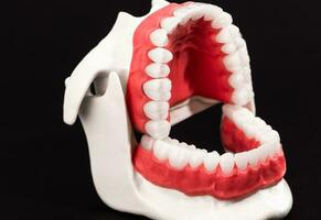 mänsklig käke med tänder och tandkött anatomi modell isolerat på svart bakgrund. öppnad käke placera. friska tänder, dental vård, och ortodontisk medicinsk sjukvård begrepp. foto