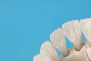 övre mänsklig käke med tänder anatomi modell isolerat på blå bakgrund. friska tänder, dental vård och ortodontisk medicinsk begrepp. foto