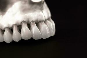 lägre mänsklig käke med tänder anatomi modell isolerat på svart bakgrund. friska tänder, dental vård och ortodontisk medicinsk begrepp. foto