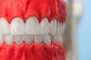 mänsklig käke med tänder och tandkött anatomi modell isolerat på blå bakgrund. friska tänder, dental vård och ortodontisk medicinsk sjukvård begrepp foto