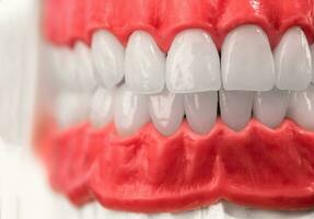 mänsklig käke med tänder och tandkött anatomi modell isolerat på blå bakgrund. friska tänder, dental vård och ortodontisk medicinsk sjukvård begrepp foto