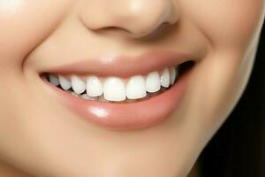 perfekt friska tänder leende av en ung kvinna på en tandläkare. tänder blekning. dental vård, stomatologi begrepp förbi ai genererad foto