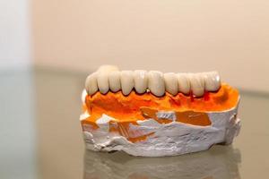 zirkonium porslin tandplatta i tandläkare butik foto