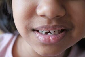 detalj skott av barn med tänder saknas foto