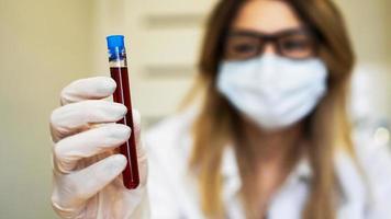 närbild av ung kvinnlig forskare som håller provrör med blodprov