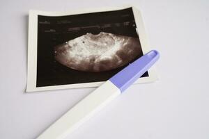 graviditet testa med ultraljud skanna Foto av foster, moderskap, förlossning, födelse kontrollera.