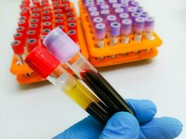teknolog håll serum prov rör och lavendel- rör med blod prov för medicinsk testa. foto
