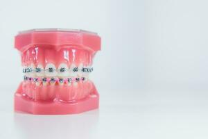 de tandställning är placerad på de tänder i de artificiell käke på en vit bakgrund. makro fotografi foto