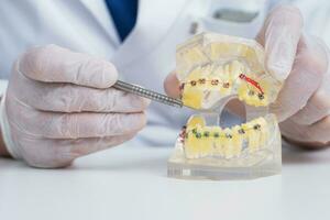 läkare ortodontist visar på vilket sätt de systemet av tandställning på tänder är anordnad foto