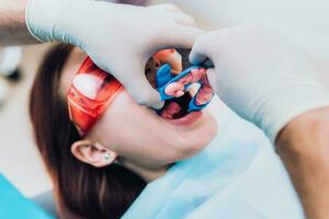 läkare ortodontist utför en procedur för rengöring tänder foto