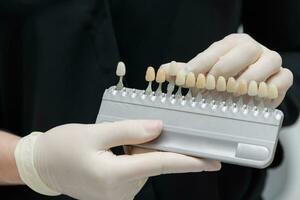 läkare ortodontist innehar i hans hand tester för en patientens tänder innan blekning foto