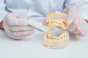 läkare ortodontist visar på vilket sätt de systemet av tandställning på tänder är anordnad foto