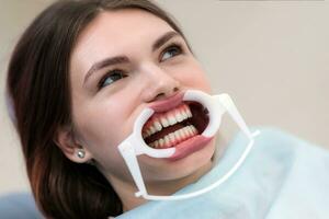 läkare ortodontist utför en procedur för rengöring tänder foto