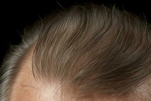 ai genererad skalp tunn gammal bakgrund frisör person problem manlig vit huvud hälsa påfrestning hår foto