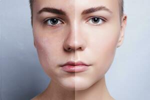 innan och efter kosmetisk drift. ung Söt kvinna porträtt foto