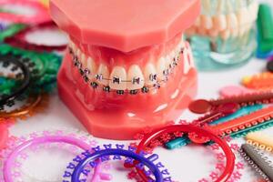 ortodontisk ligaturer ringar och slipsar, elastisk sudd band på ortodontisk tandställning, modell för tandläkare studerar handla om tandvård. foto