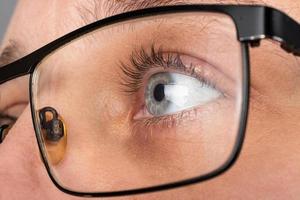 ögat med glasögon för syn. keratokonus hornhinnedystrofi foto