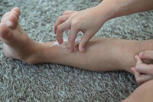 liten asiatisk Pojkar händer peeling av torr hud på hans ben. hud problem. foto