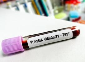 blod prov för plasma viskositet testa, diagnos för polymyalgi reumatica, jätte cell arterit eller temporal arterit, sådan som huvudvärk, nacke eller axel smärta, bäcken- smärta, gemensam stiffnes. foto