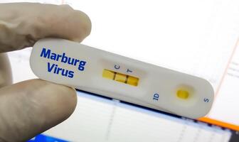 snabb testa kassett för de virus - marburg, medicin och hälsa begrepp foto