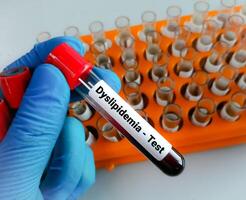 blod prov för dyslipidemi testa. hyperlipidemi. lipid profil foto