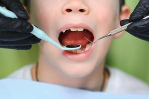 tandläkare granskning liten Pojkar tänder i klinik foto