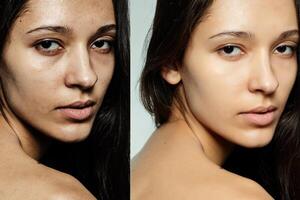 innan och efter kosmetisk drift. foto
