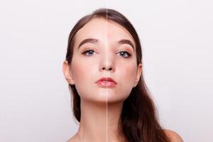 innan och efter kosmetisk drift foto