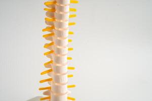 länd- ryggrad fördrivna herniated skiva fragment, spinal nerv och ben. modell för behandling medicinsk i de ortopedisk avdelning. foto
