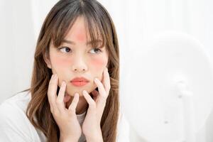 ung kvinna är orolig handla om ansikten dermatologi och allergisk till steroider i kosmetika. känslig hud, röd ansikte från solbränna, acne, allergisk till kemikalier, utslag på ansikte. hud problem och skönhet foto