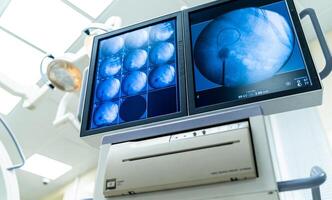 medicinsk enheter, ultraljud undersökning, interiör sjukhus design begrepp. interiör av rörelse rum i modern klinik, skärm med tester närbild foto