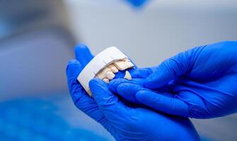 stänga upp implantera modell tand Stöd fixera bro implantera och krona. dental käke. undervisning tänder modell i läkares händer. falsk tand. närbild. foto
