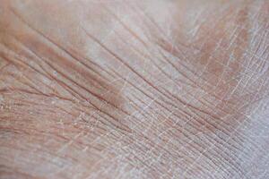 närbild se av torr mänsklig hud . foto