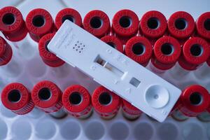 snabb testa kassett malaria på en ovan de röd Vakuum rör. visar en negativ resultat.kopia Plats foto