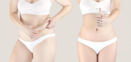 collage av 2 kvinna siffror i vit underkläder. kvinna innan och efter förlorande vikt. övervikt kvinna och smal kvinna foto