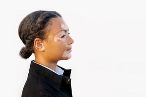 en skön ung flicka av afrikansk etnicitet med vitiligo isolerat på de vit bakgrund foto