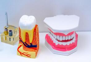 artificiell pedagogisk dental modell och tand modell för tandläkare. stomatologi begrepp. vit bakgrund. foto